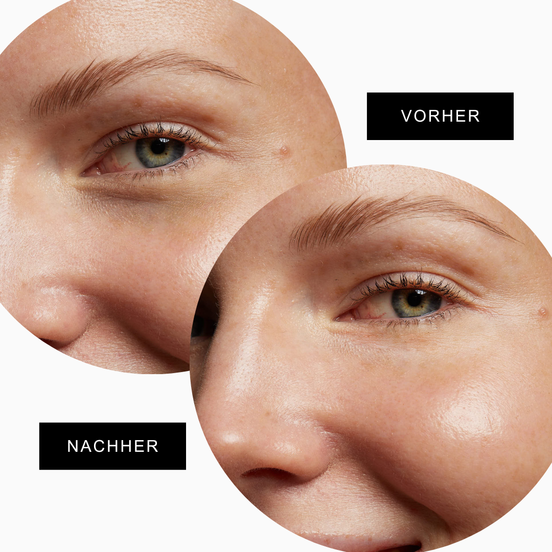 "Spread Love" Eye Pads + Eye Serum