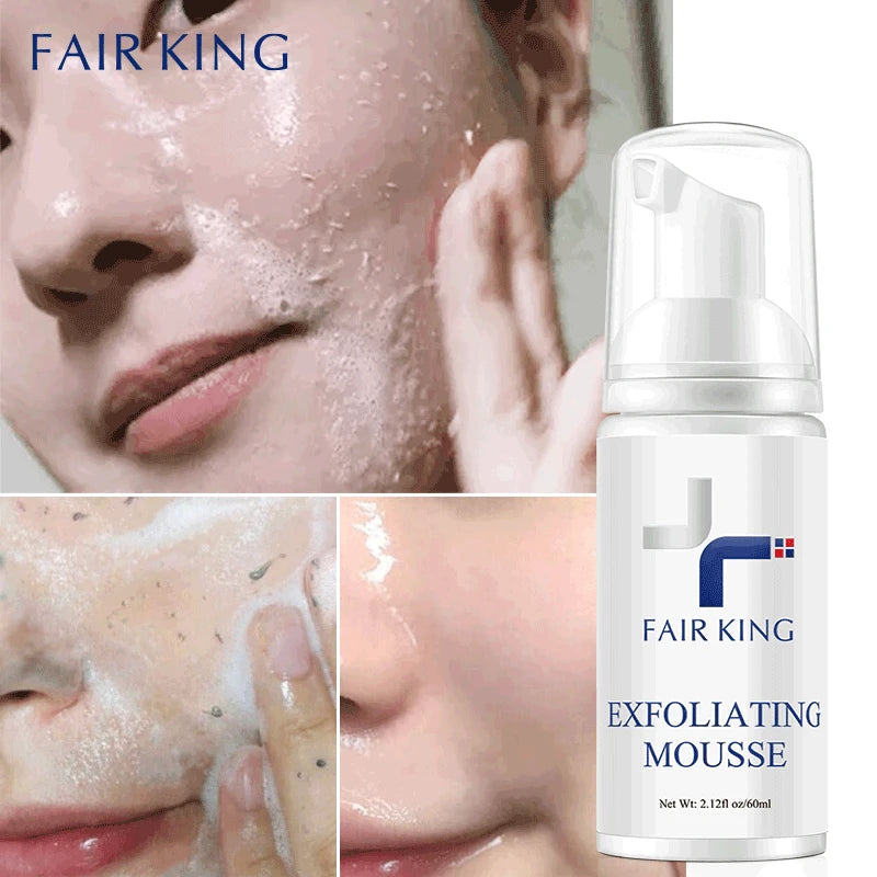 Facial Exfoliating Mousse Peeling Gel